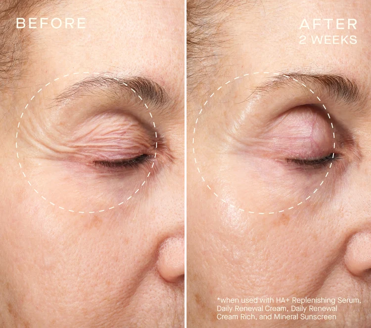 OURSELF COLLAGEN RESET REGIMEN