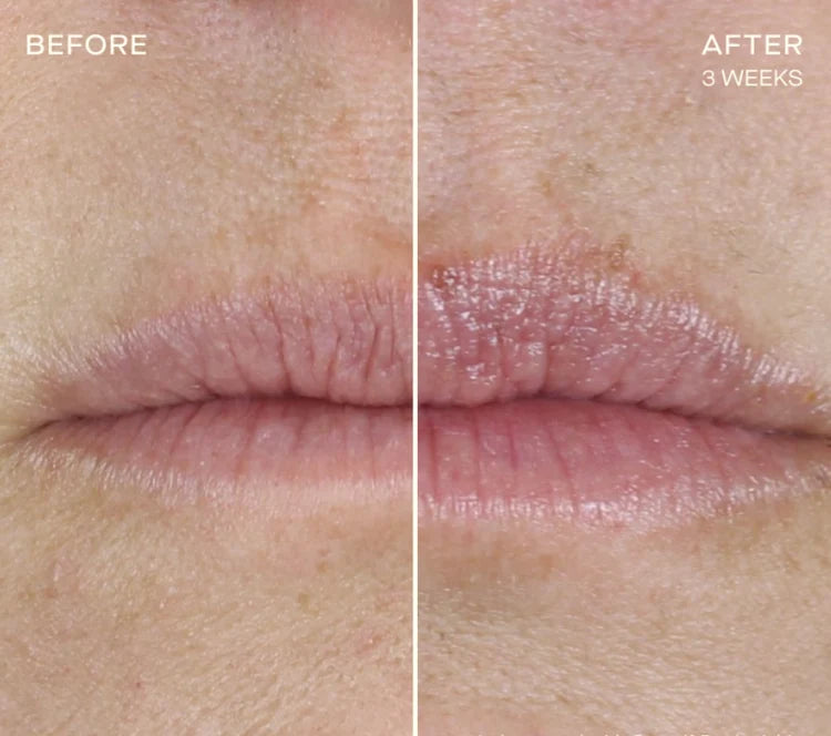 OURSELF LIP PLUMPING AND ENHANCING REGIMEN