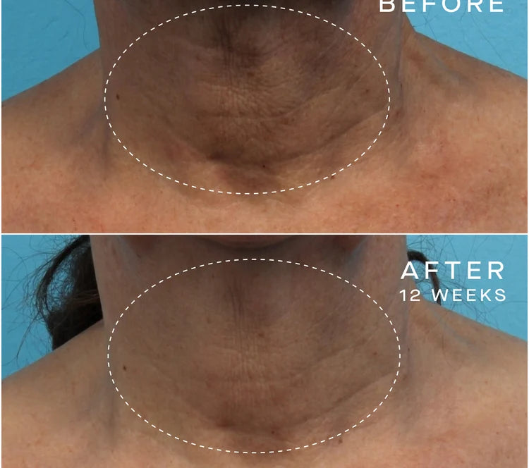 OURSELF ADVANCED REGENERATIVE SERUM