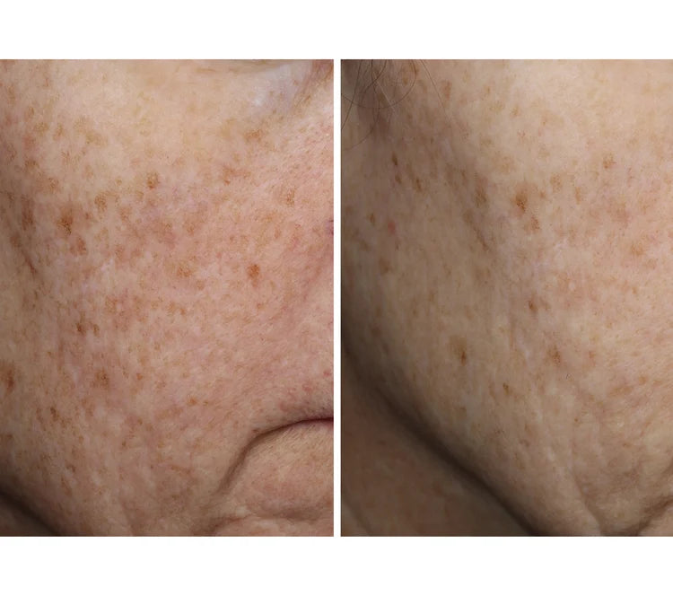 OURSELF COMPLEXION BRIGHTENING SERUM