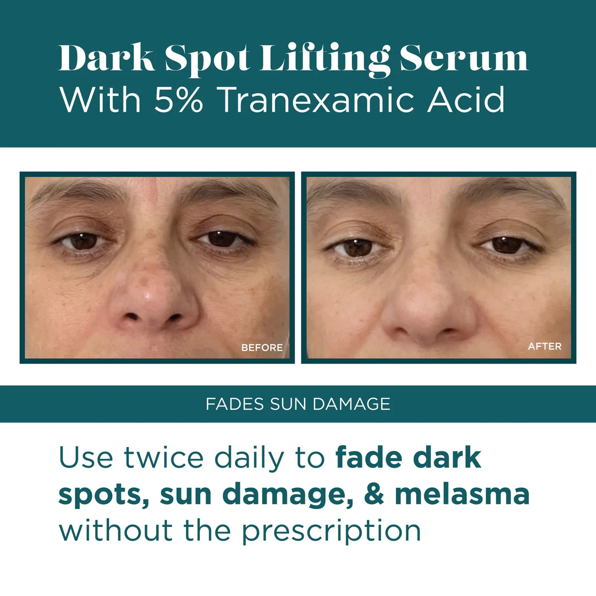 VI DERM DARK SPOT LIFTING SERUM WITH 5% TRANEXAMIC ACID