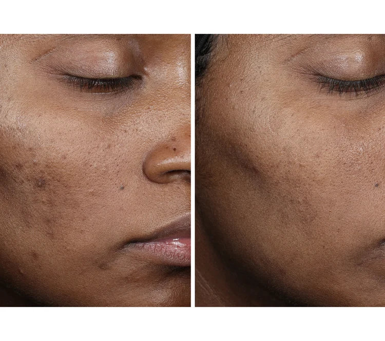 OURSELF COLLAGEN RESET REGIMEN