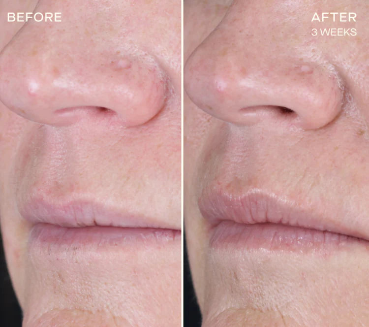 OURSELF LIP PLUMPING AND ENHANCING REGIMEN