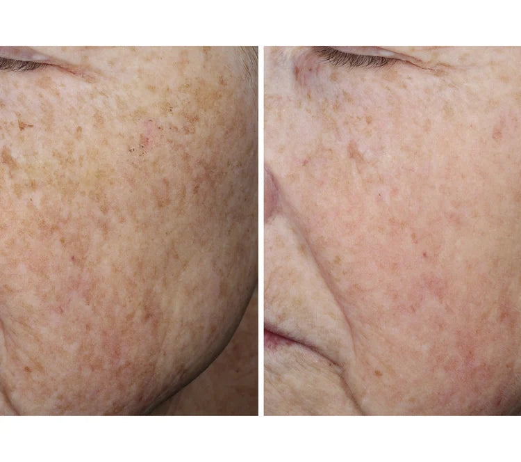 OURSELF COLLAGEN RESET REGIMEN