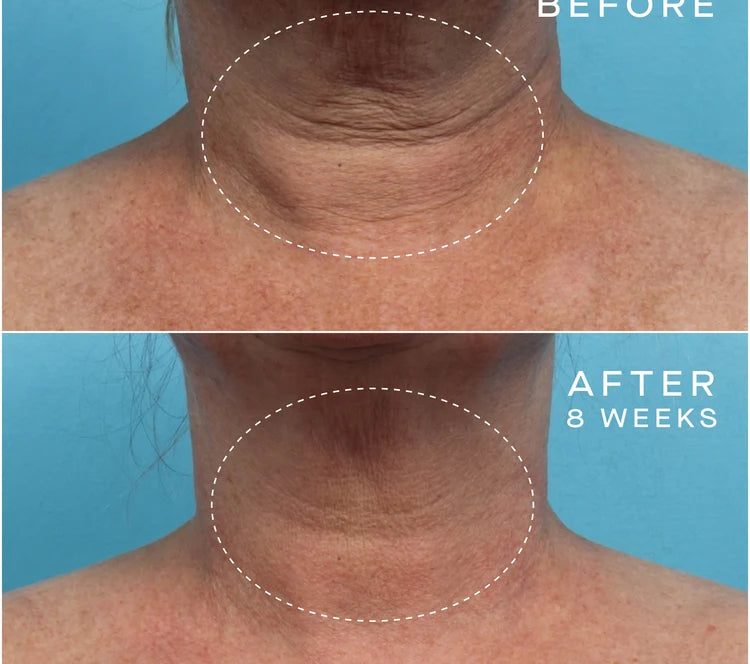 OURSELF ADVANCED REGENERATIVE SERUM